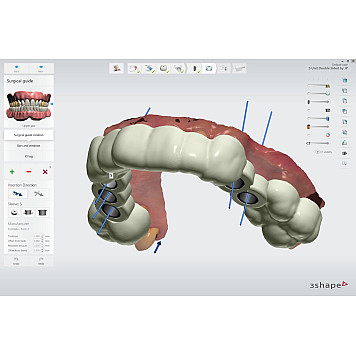 Картридж Formlabs Surgical Guide Resin 1 Л-2
