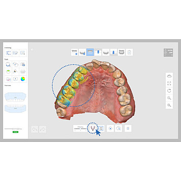 Интрооральный 3D сканер Medit I500-3
